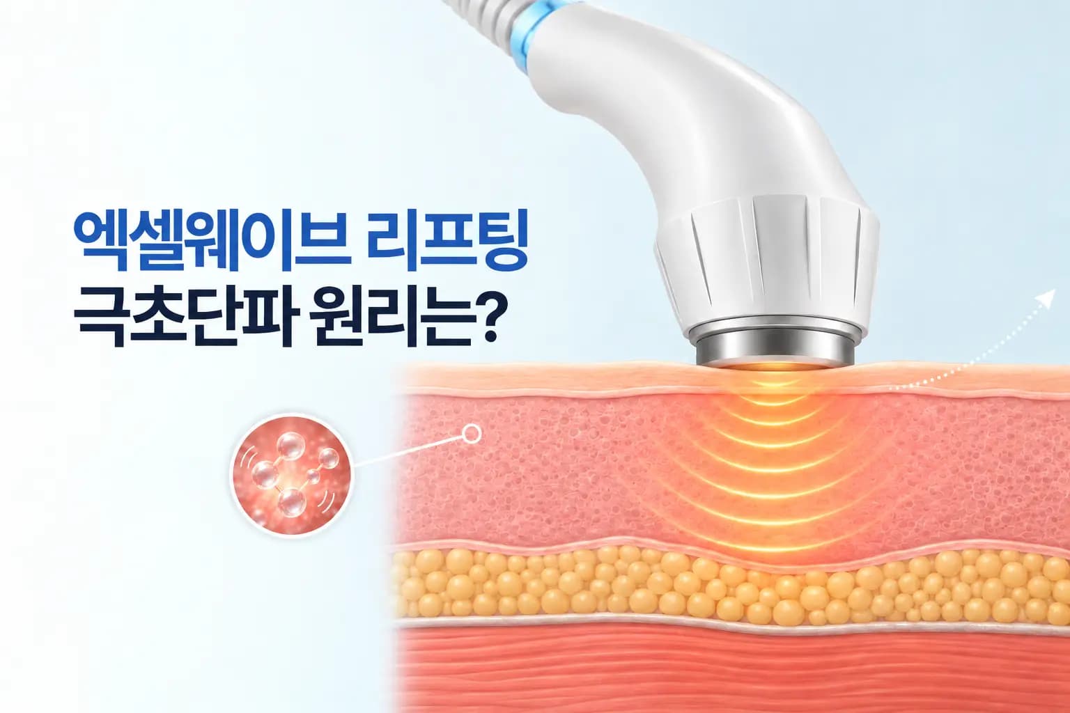 핸드피스 팁의 극초단파가 피부 속 물 분자를 진동시켜 열을 만드는 엑셀웨이브 리프팅 원리 썸네일