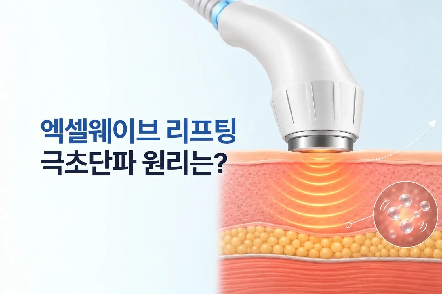 핸드피스 팁의 극초단파가 피부 속 물 분자를 진동시켜 열을 만드는 엑셀웨이브 리프팅 원리 썸네일