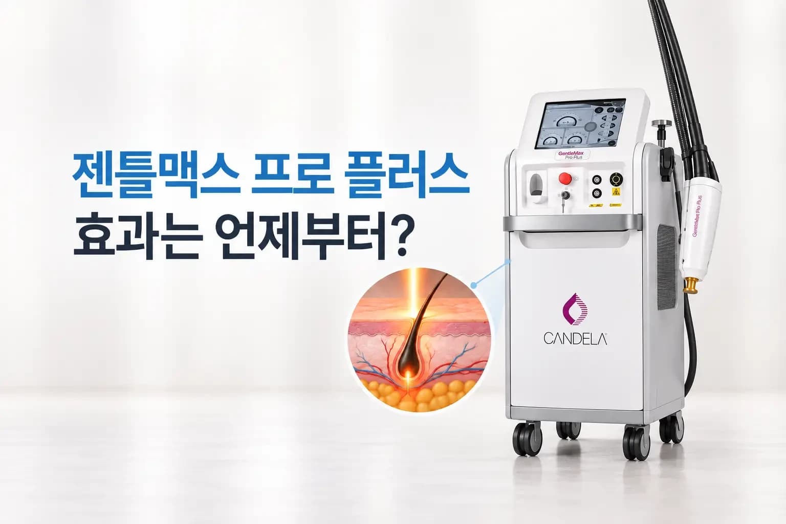 젠틀맥스 프로 플러스 핸드피스 팁이 다리 피부에 닿고 모낭에 레이저가 전달되는 효과 썸네일